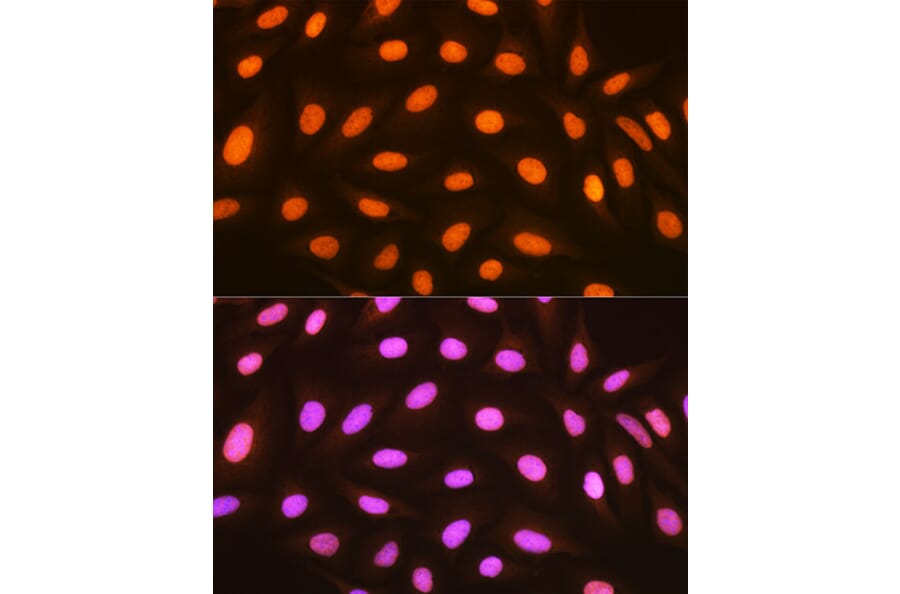 Immunofluorescence - Anti-mH2A1 Antibody [ARC1396] (A306292) - Antibodies.com