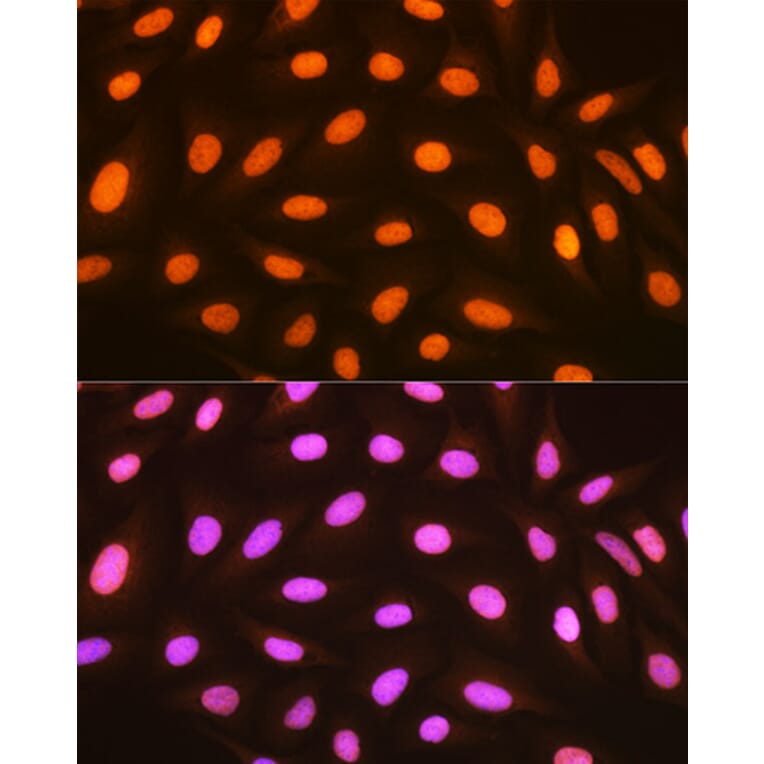 Immunofluorescence - Anti-mH2A1 Antibody [ARC1396] (A306292) - Antibodies.com