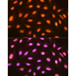 Immunofluorescence - Anti-mH2A1 Antibody [ARC1396] (A306292) - Antibodies.com