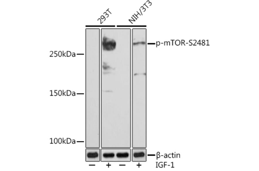 Western Blot - Anti-mTOR (phospho Ser2481) Antibody [ARC1522] (A306293) - Antibodies.com