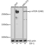 Western Blot - Anti-mTOR (phospho Ser2481) Antibody [ARC1522] (A306293) - Antibodies.com
