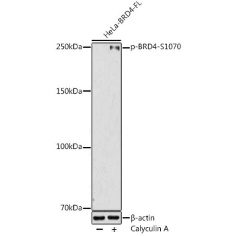 Western Blot - Anti-Brd4 (phospho Ser1070) Antibody (A306294) - Antibodies.com