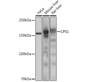 Western Blot - Anti-CPS1 Antibody [ARC0929] (A306295) - Antibodies.com