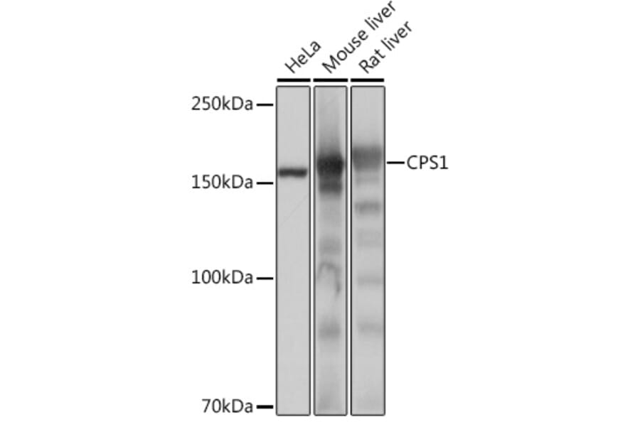 Western Blot - Anti-CPS1 Antibody [ARC0929] (A306295) - Antibodies.com