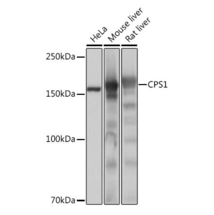 Western Blot - Anti-CPS1 Antibody [ARC0929] (A306295) - Antibodies.com