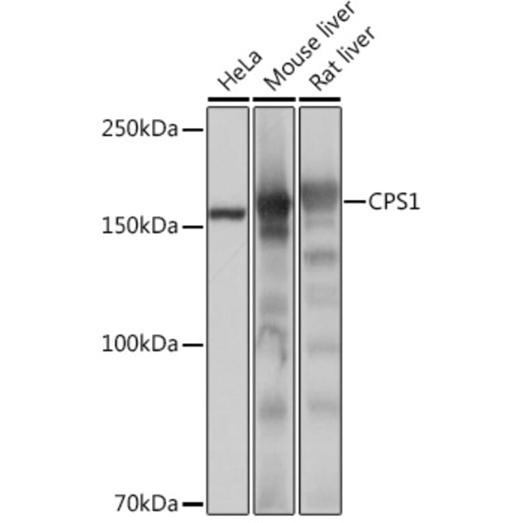 Western Blot - Anti-CPS1 Antibody [ARC0929] (A306295) - Antibodies.com