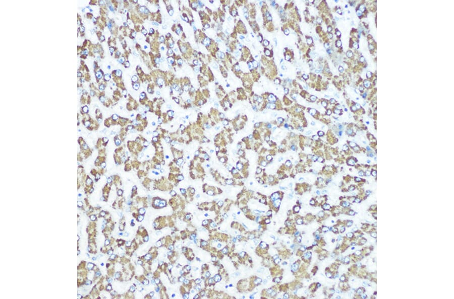 Immunohistochemistry - Anti-CPS1 Antibody [ARC0929] (A306295) - Antibodies.com
