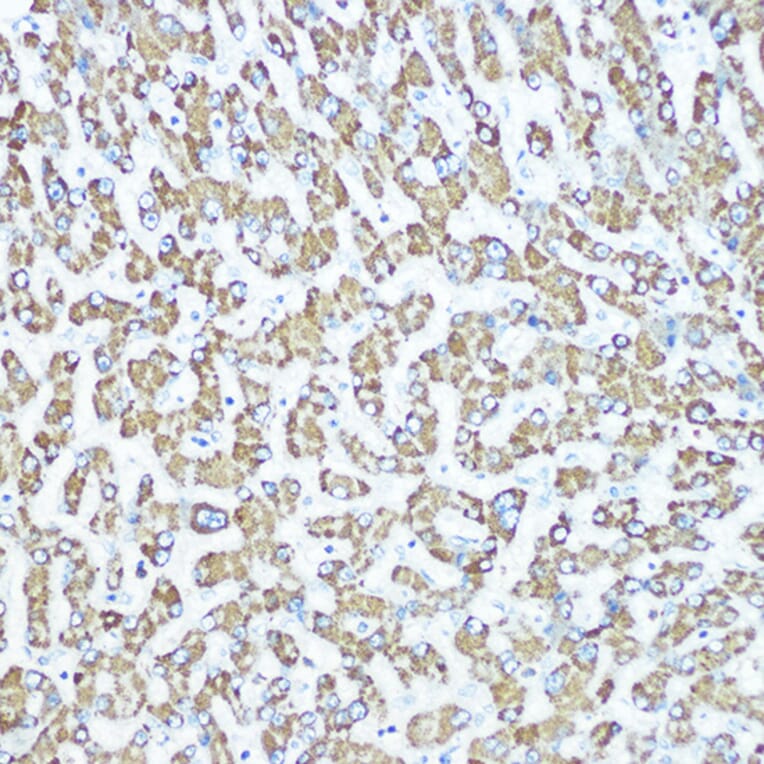 Immunohistochemistry - Anti-CPS1 Antibody [ARC0929] (A306295) - Antibodies.com