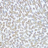 Immunohistochemistry - Anti-CPS1 Antibody [ARC0929] (A306295) - Antibodies.com