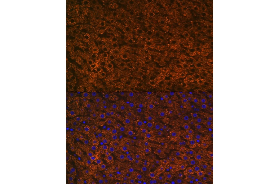 Immunofluorescence - Anti-CPS1 Antibody [ARC0929] (A306295) - Antibodies.com