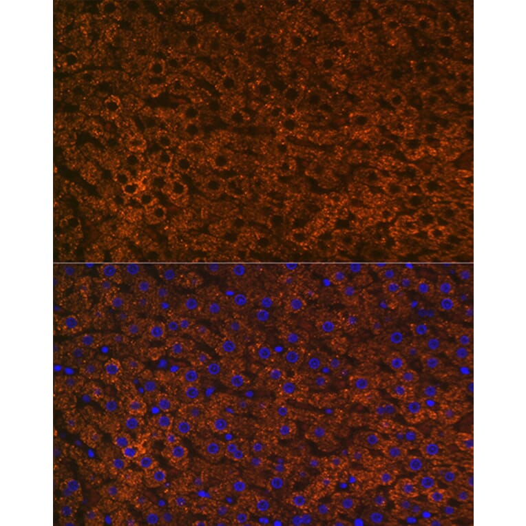 Immunofluorescence - Anti-CPS1 Antibody [ARC0929] (A306295) - Antibodies.com