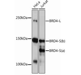Western Blot - Anti-Brd4 Antibody [ARC0699] (A306296) - Antibodies.com