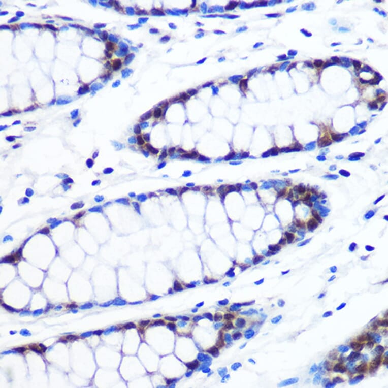 Immunohistochemistry - Anti-Brd4 Antibody [ARC0699] (A306296) - Antibodies.com