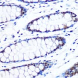 Immunohistochemistry - Anti-Brd4 Antibody [ARC0699] (A306296) - Antibodies.com