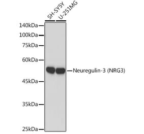 Western Blot - Anti-NRG3 Antibody [ARC2289] (A306297) - Antibodies.com