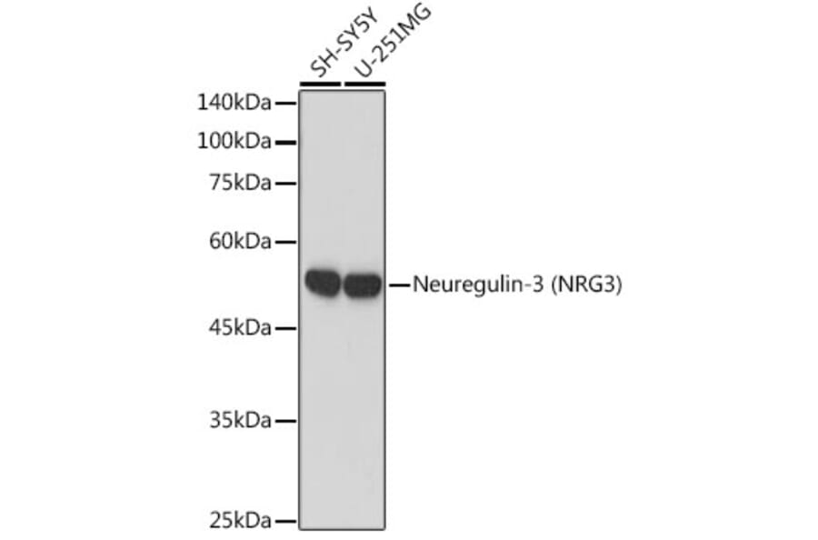 Western Blot - Anti-NRG3 Antibody [ARC2289] (A306297) - Antibodies.com