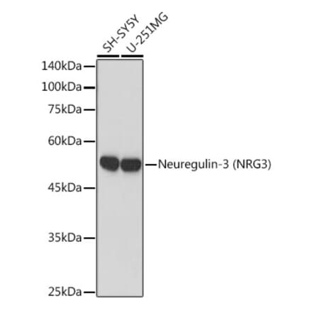 Western Blot - Anti-NRG3 Antibody [ARC2289] (A306297) - Antibodies.com