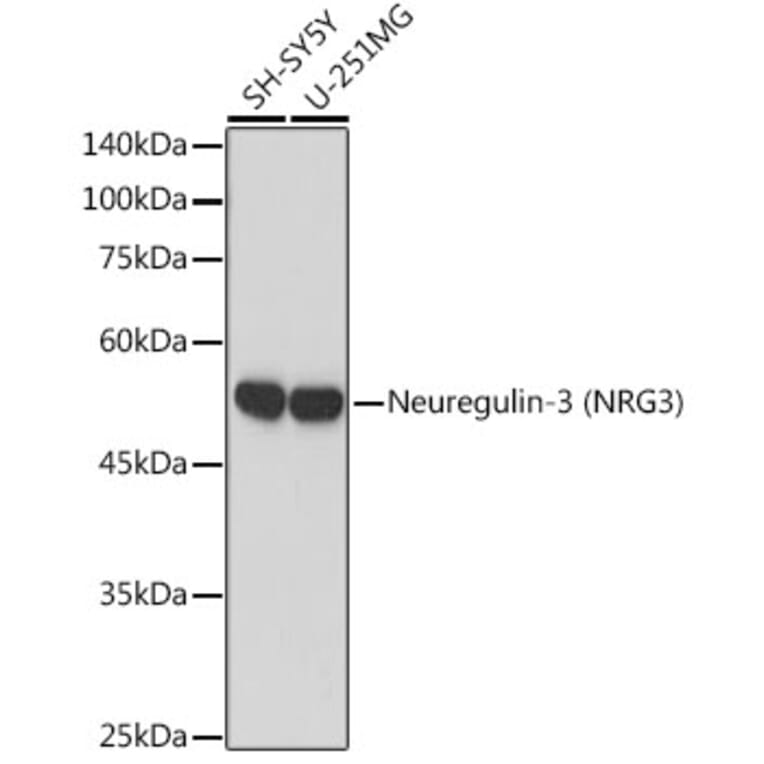 Western Blot - Anti-NRG3 Antibody [ARC2289] (A306297) - Antibodies.com