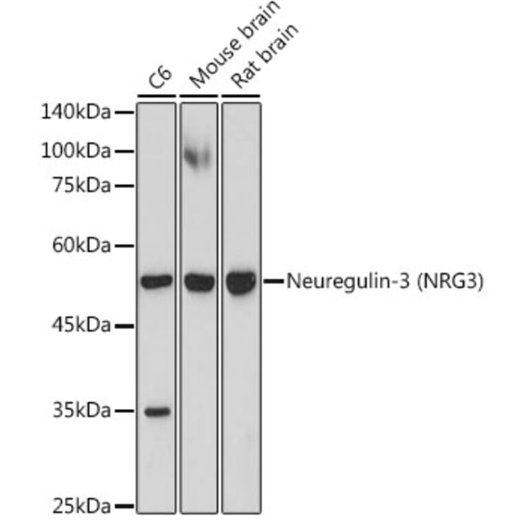 Western Blot - Anti-NRG3 Antibody [ARC2289] (A306297) - Antibodies.com