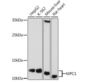Western Blot - Anti-MPC1 Antibody (A306298) - Antibodies.com