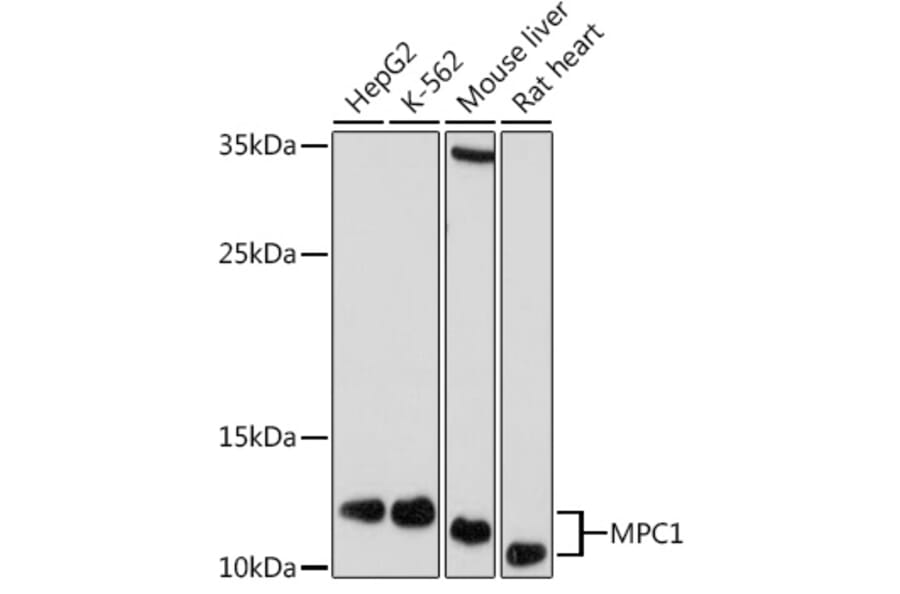 Western Blot - Anti-MPC1 Antibody (A306298) - Antibodies.com