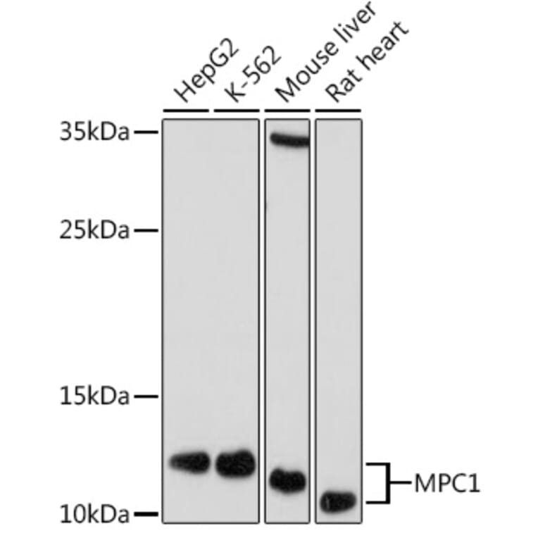 Western Blot - Anti-MPC1 Antibody (A306298) - Antibodies.com