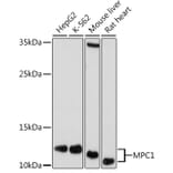 Western Blot - Anti-MPC1 Antibody (A306298) - Antibodies.com