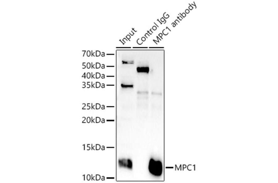 Western Blot - Anti-MPC1 Antibody (A306298) - Antibodies.com