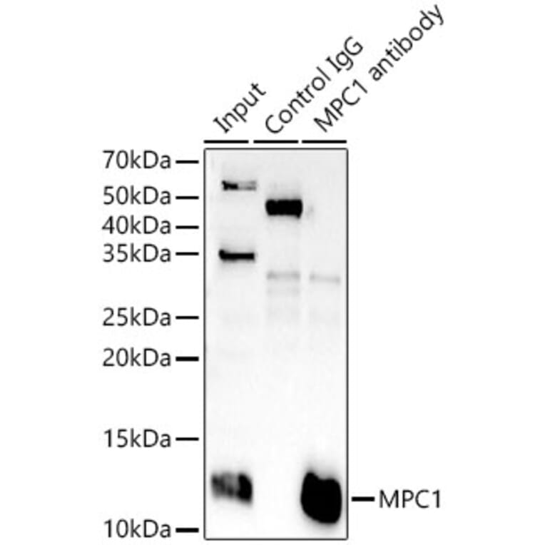 Western Blot - Anti-MPC1 Antibody (A306298) - Antibodies.com