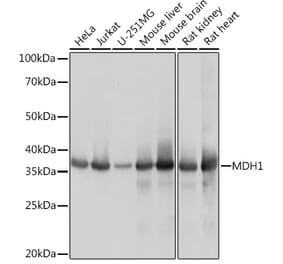 Western Blot - Anti-MDH1 Antibody [ARC1692] (A306299) - Antibodies.com