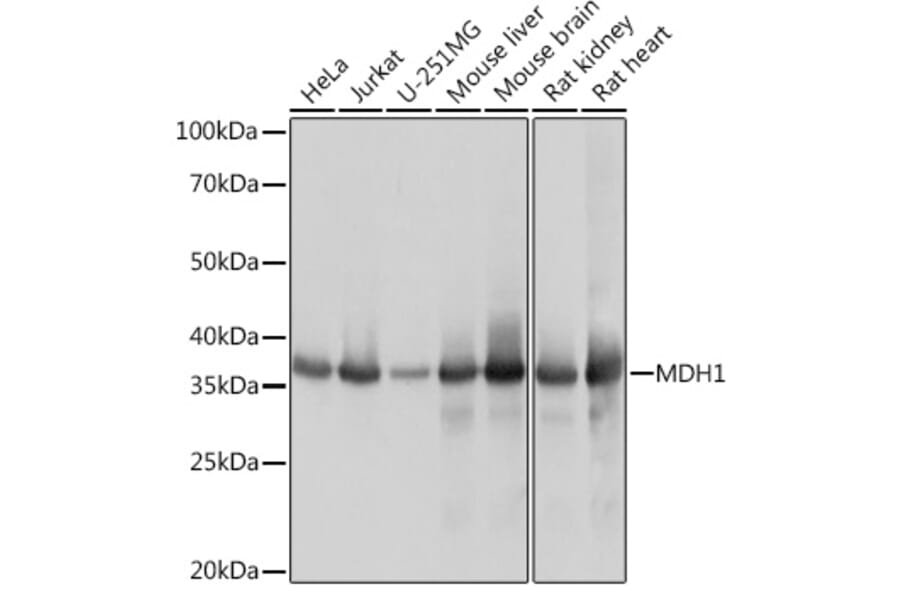 Western Blot - Anti-MDH1 Antibody [ARC1692] (A306299) - Antibodies.com