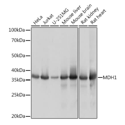 Western Blot - Anti-MDH1 Antibody [ARC1692] (A306299) - Antibodies.com