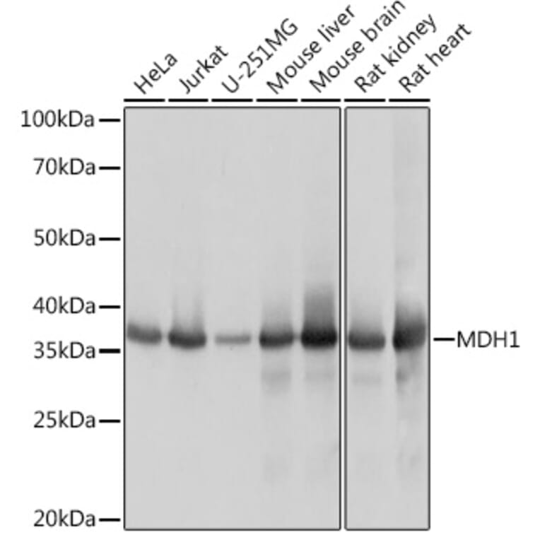 Western Blot - Anti-MDH1 Antibody [ARC1692] (A306299) - Antibodies.com