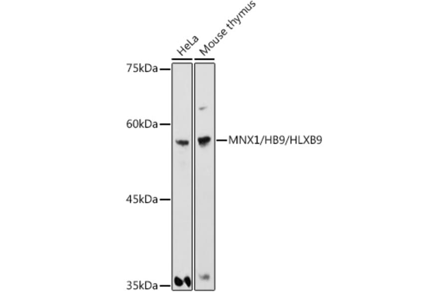 Western Blot - Anti-HB9/HLXB9/MNX1 Antibody (A306300) - Antibodies.com