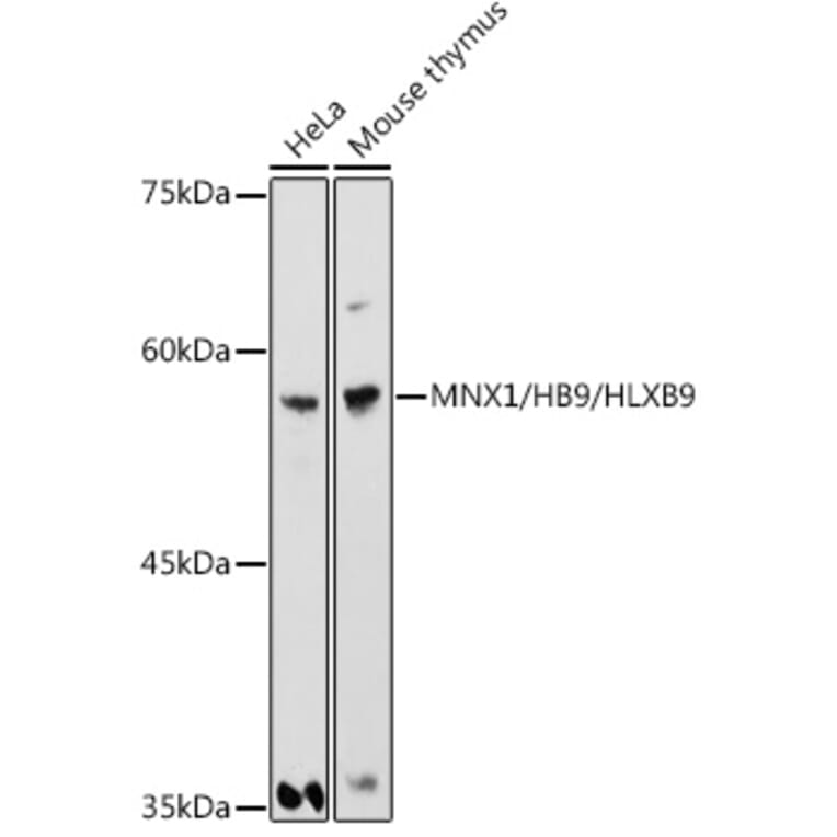 Western Blot - Anti-HB9/HLXB9/MNX1 Antibody (A306300) - Antibodies.com