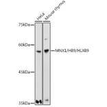 Western Blot - Anti-HB9/HLXB9/MNX1 Antibody (A306300) - Antibodies.com