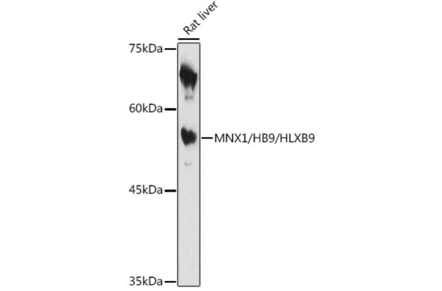 Western Blot - Anti-HB9/HLXB9/MNX1 Antibody (A306300) - Antibodies.com