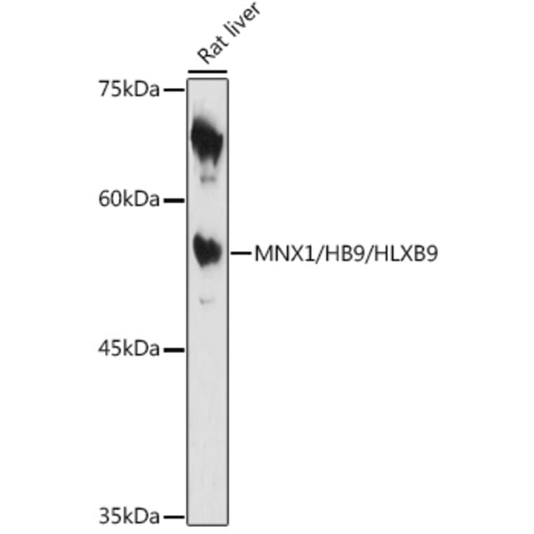 Western Blot - Anti-HB9/HLXB9/MNX1 Antibody (A306300) - Antibodies.com