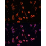 Immunofluorescence - Anti-MT-ATP6 Antibody (A306301) - Antibodies.com
