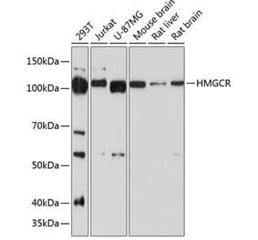 Western Blot - Anti-HMGCR Antibody [ARC0496] (A306303) - Antibodies.com