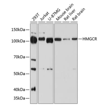 Western Blot - Anti-HMGCR Antibody [ARC0496] (A306303) - Antibodies.com