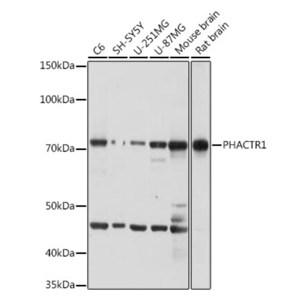 Western Blot - Anti-PHACTR1 Antibody (A306304) - Antibodies.com