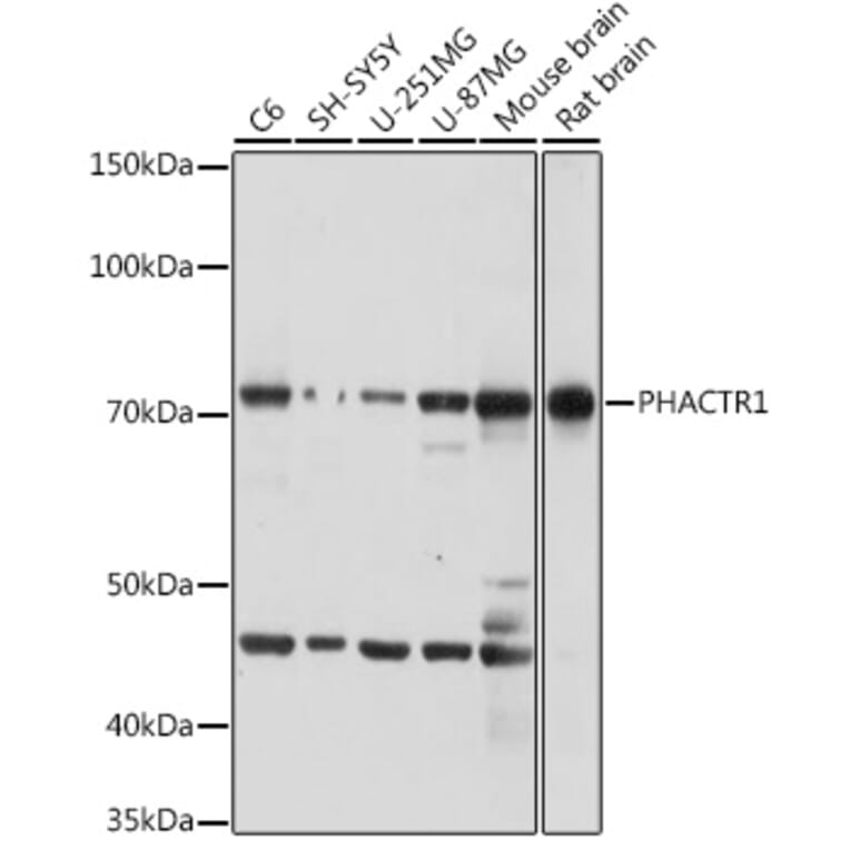 Western Blot - Anti-PHACTR1 Antibody (A306304) - Antibodies.com