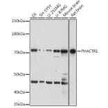 Western Blot - Anti-PHACTR1 Antibody (A306304) - Antibodies.com