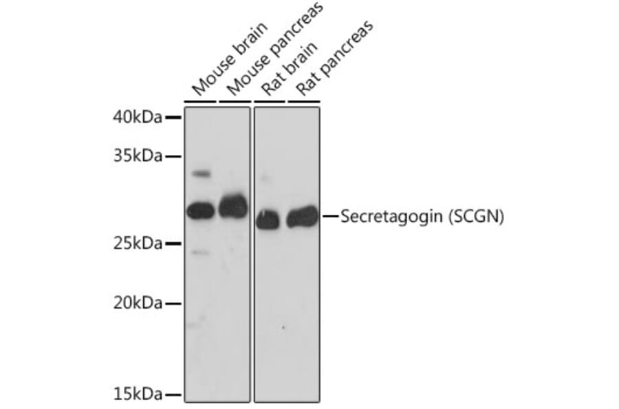 Western Blot - Anti-SCGN/Secretagogin Antibody [ARC2196] (A306306) - Antibodies.com