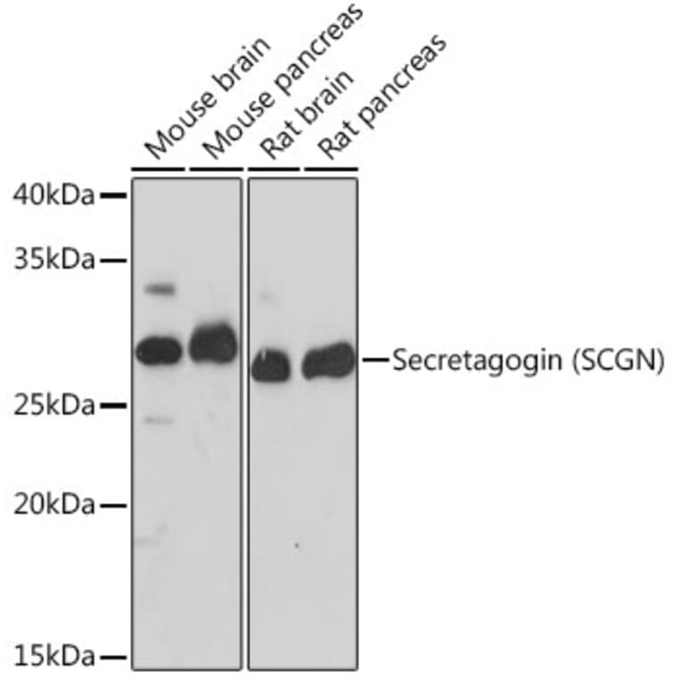 Western Blot - Anti-SCGN/Secretagogin Antibody [ARC2196] (A306306) - Antibodies.com