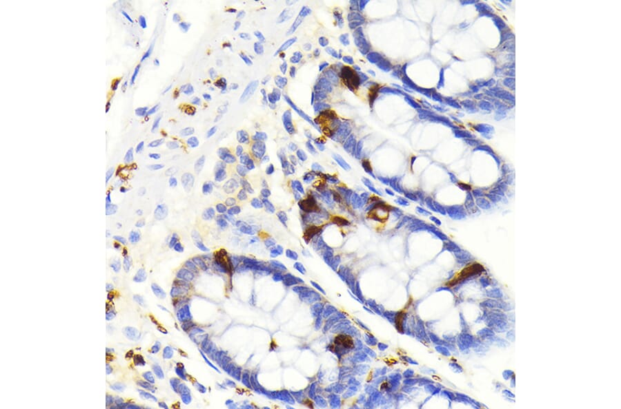 Immunohistochemistry - Anti-SCGN/Secretagogin Antibody [ARC2196] (A306306) - Antibodies.com