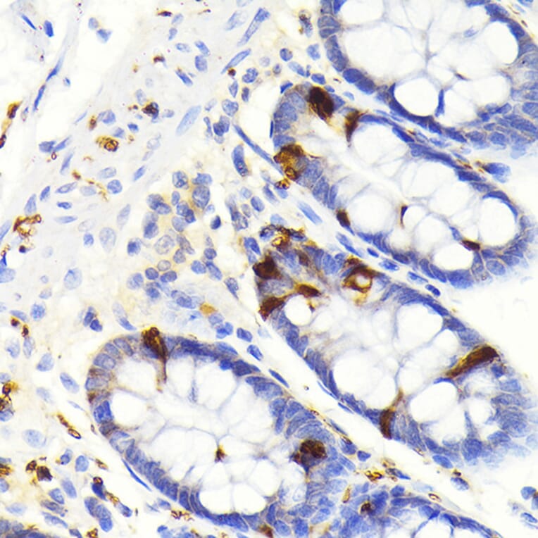 Immunohistochemistry - Anti-SCGN/Secretagogin Antibody [ARC2196] (A306306) - Antibodies.com
