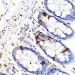 Immunohistochemistry - Anti-SCGN/Secretagogin Antibody [ARC2196] (A306306) - Antibodies.com