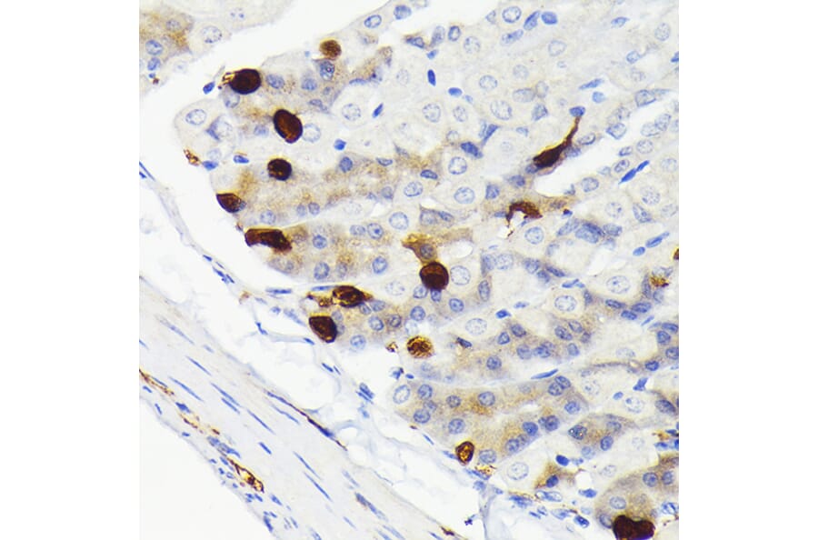 Immunohistochemistry - Anti-SCGN/Secretagogin Antibody [ARC2196] (A306306) - Antibodies.com